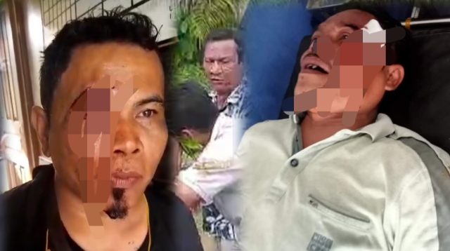 Foto : Kedua saksi Prabowo-Gibran yang dianiaya di Kabupaten Tapanuli Tengah