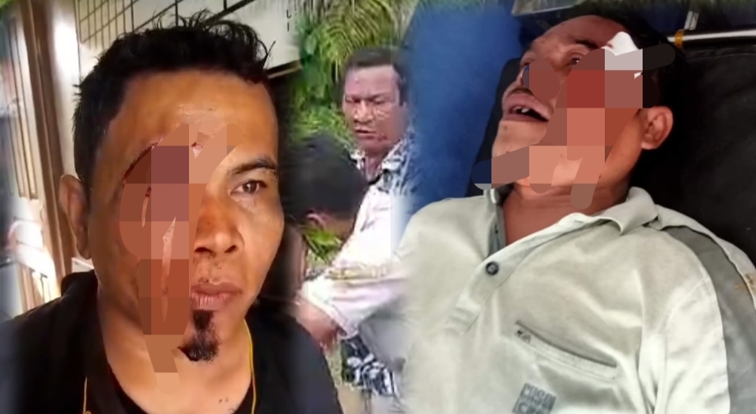 Foto : Kedua saksi Prabowo-Gibran yang dianiaya di Kabupaten Tapanuli Tengah